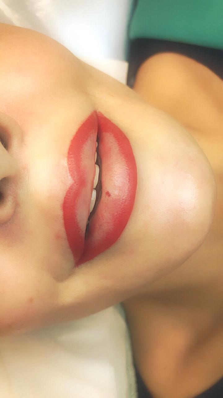 Lip Procedure Course